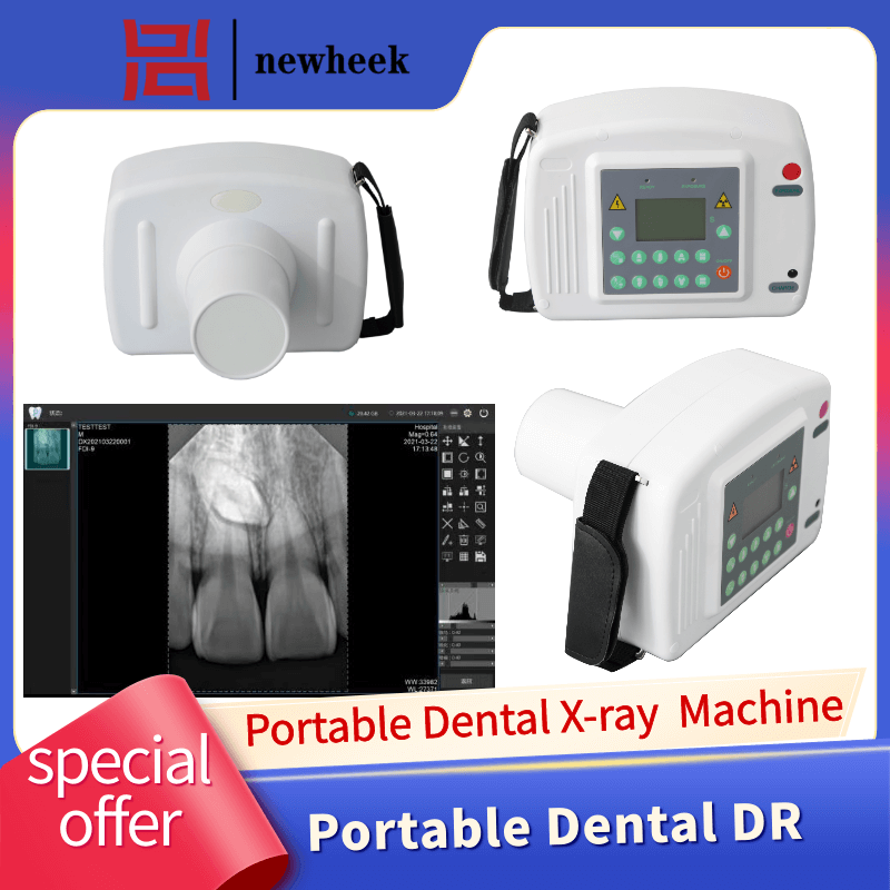 Single tooth X-ray machine